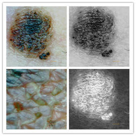 Câmera da pele e do escalpe do analisador da pele do microscópio de Digitas do inspetor da pele com definição de pixéis de 5M
