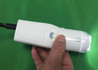 Colposcope eletrônico de Digitas da câmera Vaginal para encontrar a doença da cerviz Eealier