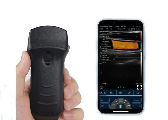 Scanner de bexiga de ultrassom portátil Wifi de 305 mm sonda convexa+linear+cardíaca