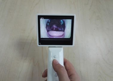 Ophthalmoscope diagnóstico OTORRINOLARINGOLÓGICO do Otoscope do equipamento do armazenamento de cartão do SD automaticamente com cabo de USB