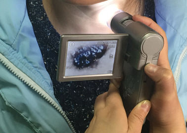 Câmera video eletrônica de Dermatoscope do dispositivo da inspeção da pele e do cabelo com projeção a cores de TFT de 3 polegadas