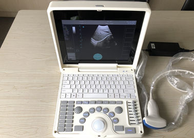 O zumbido inteligente 12&quot; do varredor portátil do ultra-som da gravidez LCD Mão-levou com ponta de prova 3.5MHz convexa