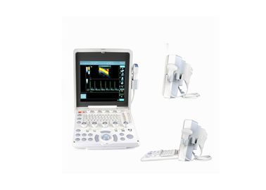 a máquina cardíaca portátil opcional do ultrassom de Doppler da cor 3D detecta com a tela do diodo emissor de luz de 12,1 polegadas