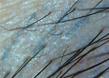 microscópio Digital Dermatoscope video da pele da lente de aumento 1000x para o microscópio completo da inspeção médica