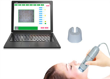 Analisador inteligente facial video esperto da pele da umidade HD da câmera da pele de Dermatoscope