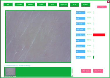 Sistema de análise video profissional de Dermatoscope com análise e relatório de testes