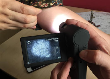 Os pixéis Handheld do analisador 5M da pele de Dermatoscope Digital apoiaram o PC do sistema da janela