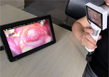Otoscope video médico esperto do CMOS USB de 1920 x 1080 pixéis para a pele da orelha e a imagem latente geral