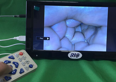 Das saídas de vídeo câmera eletrônica da ginecologia do Colposcope de Digitas completamente com guia do usuário