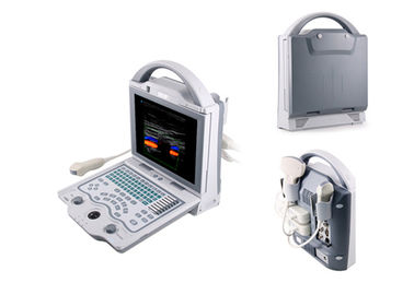 Sistema diagnóstico da cor do varredor do ultrassom do portátil da máquina de Doppler da cor de Digitas