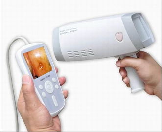Colposcope cervical Handheld da câmera de Digitas para que a ginecologia inspecione a cerviz com 80,0000 zumbido da definição 1~128 dos pixéis