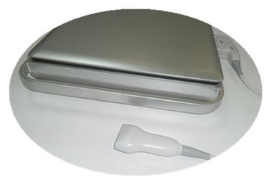 varredor do ultrassom de Doppler da cor 3d/Doppler à mão com bateria incorporado