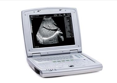 Varredor portátil do ultrassom da máquina da varredura do ultrassom com o monitor do diodo emissor de luz de 10,4 polegadas