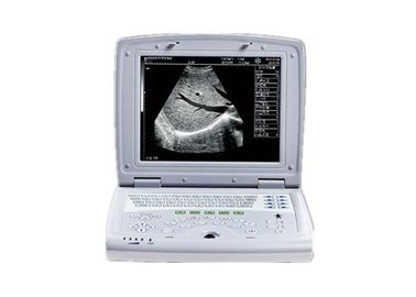 Varredor preto e branco portátil do ultrassom da máquina do ultrassom de Digitas em quatro línguas