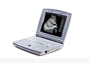 Varredor portátil do ultrassom da máquina portátil do ultrassom do bebê para a pediatria