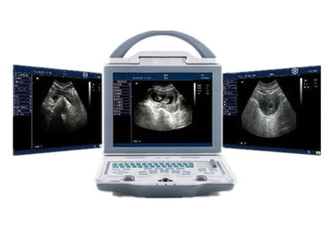 Varredor portátil do ultrassom da máquina do ultrassom do hospital com os conectores duplos da ponta de prova