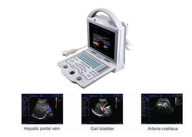 Máquina portátil do ultrassom de Doppler do varredor do ultrassom de B com somente peso 4.5Kgs