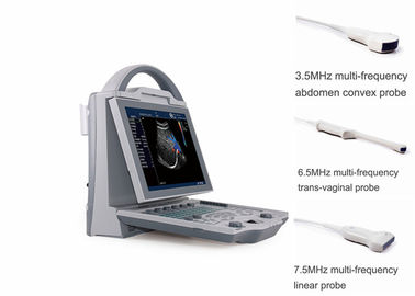 Varredor portátil do ultrassom da gravidez com os transdutores Transvaginal convexos abdominais
