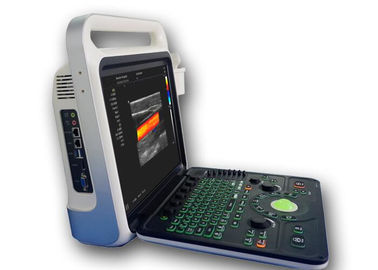 Varredor portátil do ultrassom da máquina da imagem latente do ultrassom com capacidade 160G