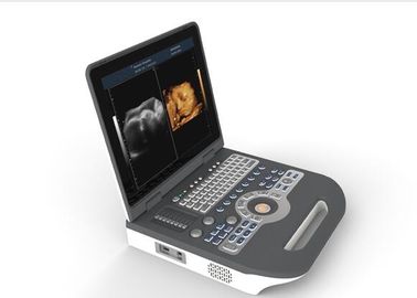 Equipamento portátil do ultrassom do varredor 4d do ultrassom da máquina médica do ultrassom