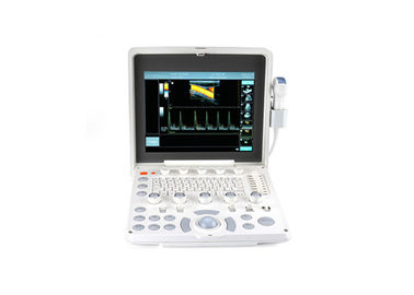 Colora o varredor portátil do ultrassom do sistema do ultrassom de Doppler com o monitor do diodo emissor de luz de 12,1 polegadas e os 2 portos da ponta de prova
