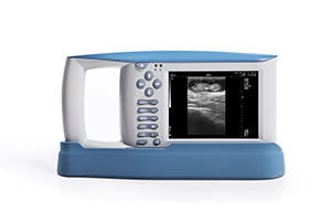 Equipamento diagnóstico do ultrassom de USB com software de OB para animais e armazenamento de 100 imagens