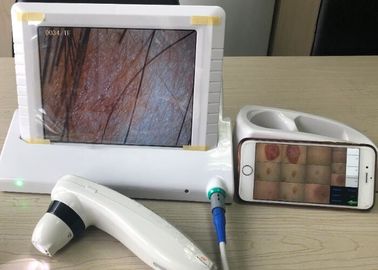 Digitas Dermatoscope video Handheld com indicação de 8 imagens da tela 1,4,9 da polegada
