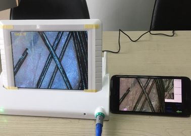 Analisador video Handheld da pele de Dermatoscope da lente de aumento de Digitas com relatório dos dados do pigmento da umidade do óleo flexível