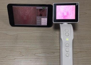 Conexão video Handheld de Digitas Dermatoscope Dermatoscope Wifi ao telefone celular tela de 3,5 polegadas