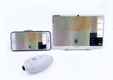 O rádio video do varredor do cabelo da pele de HD Digitas Dermatoscope conectado a Mobilophone apoiou IOS Andriod
