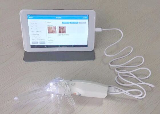Colposcope video de Digitas para o cuidado da mulher câmera profissional do monitor médico de 10 ou 7 polegadas para a inspeção da cerviz