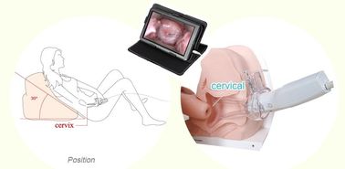 O Colposcope eletrônico endoscópico Gynecological de Digitas do produto dos cuidados médicos para mulheres dirige o uso
