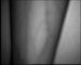 Imagens vasculares que indicam as veias no inventor infravermelho da veia da tela para enfermeiras e doutores