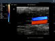 Varredor diagnóstico portátil do ultrassom da cor da máquina completa de Dopple da cor de Digitas