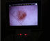 O Lcd monitora o Ophthalmoscope video do Otoscope de Digitas para a inspeção clínica do corpo humano