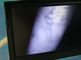 Dispositivo infravermelho do localizador da veia da imagem vascular de alta resolução para o paciente obeso
