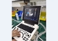 Máquina de diagnóstico por ultrassom portátil Sonda para laptop Equipamento Doppler colorido