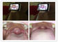 Lente geral video da imagem latente do micro dispositivo da inspeção da orelha de Digitas do cartão de memória do SD para a inspeção da garganta