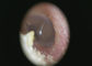 Otoscope video médico esperto do CMOS USB de 1920 x 1080 pixéis para a pele da orelha e a imagem latente geral
