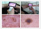 Microscópio video Handheld e medida da pele do Usb Dermatoscope dos pixéis 1920*1080 com porta usb Wifi opcional