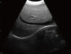 O varredor médico diagnóstico do ultrassom do portátil do ultrassom do diodo emissor de luz de 12 polegadas com uma ponta de prova conecta o software do veterinário disponível