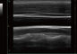 O varredor médico diagnóstico do ultrassom do portátil do ultrassom do diodo emissor de luz de 12 polegadas com uma ponta de prova conecta o software do veterinário disponível