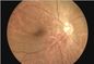 Câmera do fundo do Ophthalmoscope H.264 Digitas da inspeção