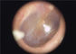 Endoscópio portátil médico disponível do Otoscope da capa protetora para as orelhas descartável para a garganta do olho da orelha