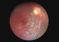 Endoscópio video de Dermatoscope Digital do Otoscope da câmera oftálmico da garganta do equipamento ótico com os 2 milhão pixéis