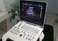 Colora o equipamento médico do ultrassom da máquina do ultrassom de Doppler com 5 línguas dos tipos