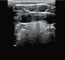 Rádio Handheld diagnóstico do equipamento do varredor do ultrassom com 8 ajustes de TGC