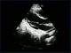 Varredor Fetal do ultrassom de Doppler da cor da língua de Mutil com micro - ponta de prova convexa