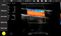 Sistema móvel do ultrassom de Doppler da cor compatível a Windows/Android/IOS