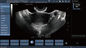 Varredor móvel do ultrassom de Doppler da cor da ponta de prova Transvaginal para a gravidez